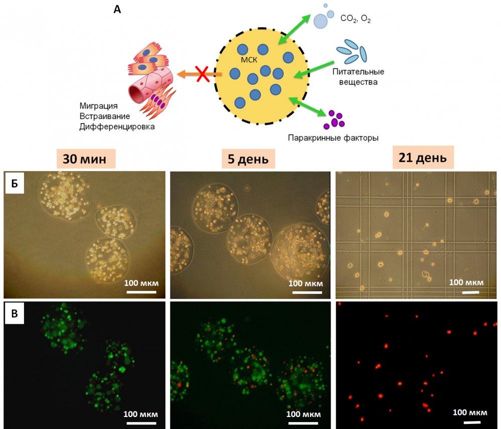 Рисунок 1. Микроинкапсулирование мезенхимных стволовых клеток. А – Принцип действия микрокапсул из полупроницаемого полимера, содержащих стволовые клетки; Б, В – репрезентативные микрофотографии микрокапсул в разные сроки после микроинкапсулирования (30 минут, 5 день, 21 день): Б – световая микроскопия; В - оценка жизнеспособности МСК с помощью комбинированного флуоресцентного красителя LIVE/DEAD Kit (Life Technologies, США).