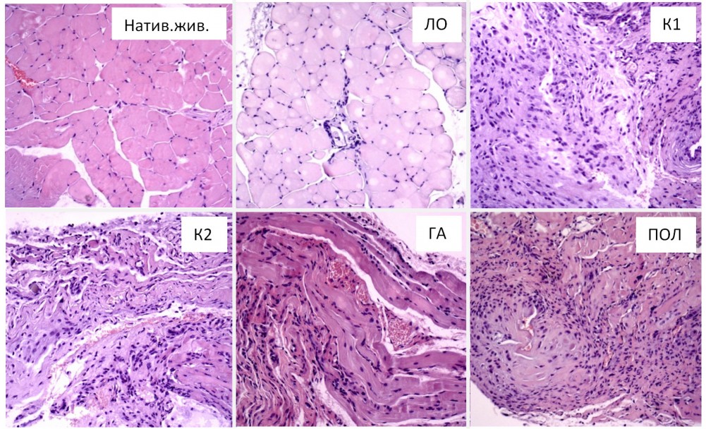 Рисунок 2. Репрезентативные микрофотографии большой грудной мышцы через 3 недели после имплантации исследуемых материалов. Натив.жив. – нативные животные; ЛО – ложнооперированные животные; К1 – композиционный материал №1 (соотношение гидроксиапатита к сополимеру лактида и гликолида 95:5 мас.%); К2 – композиционный материал №2 (соотношение гидроксиапатита к сополимеру лактида и гликолида 93:7 мас.%); ГА – гидроксиапатит; ПОЛ – сополимер лактида и гликолида.