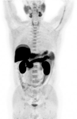 Холин Норма