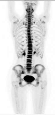 Фторид норма