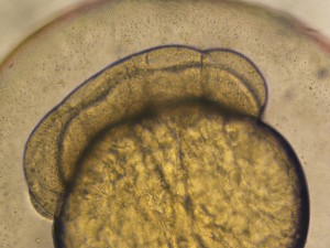 16 клеточная стадия ZF