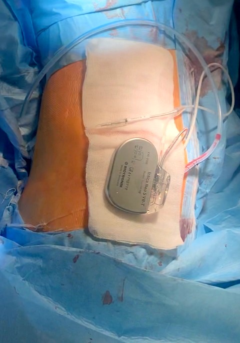 2021-11-09 at 15.49.31_0_0