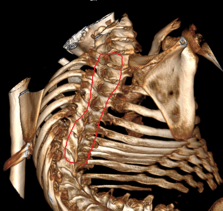 3D-КТ планирование доступа