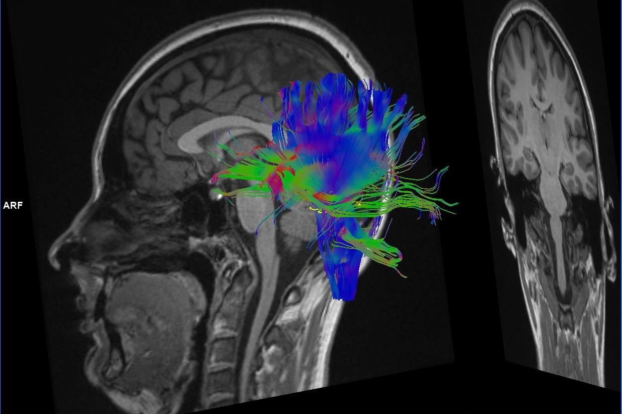 helloquence-OQMZwNd3ThU_0