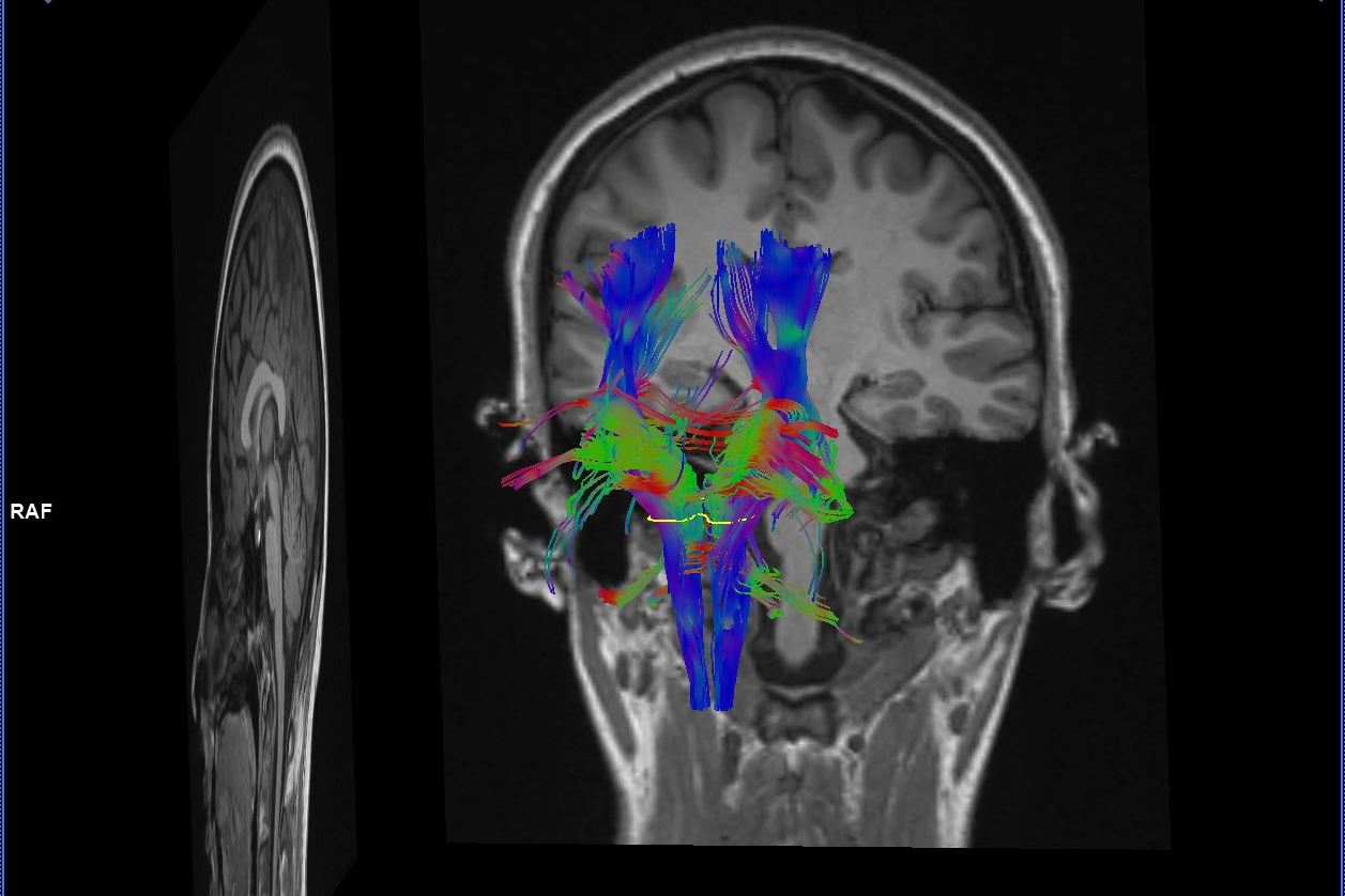 helloquence-OQMZwNd3ThU_0