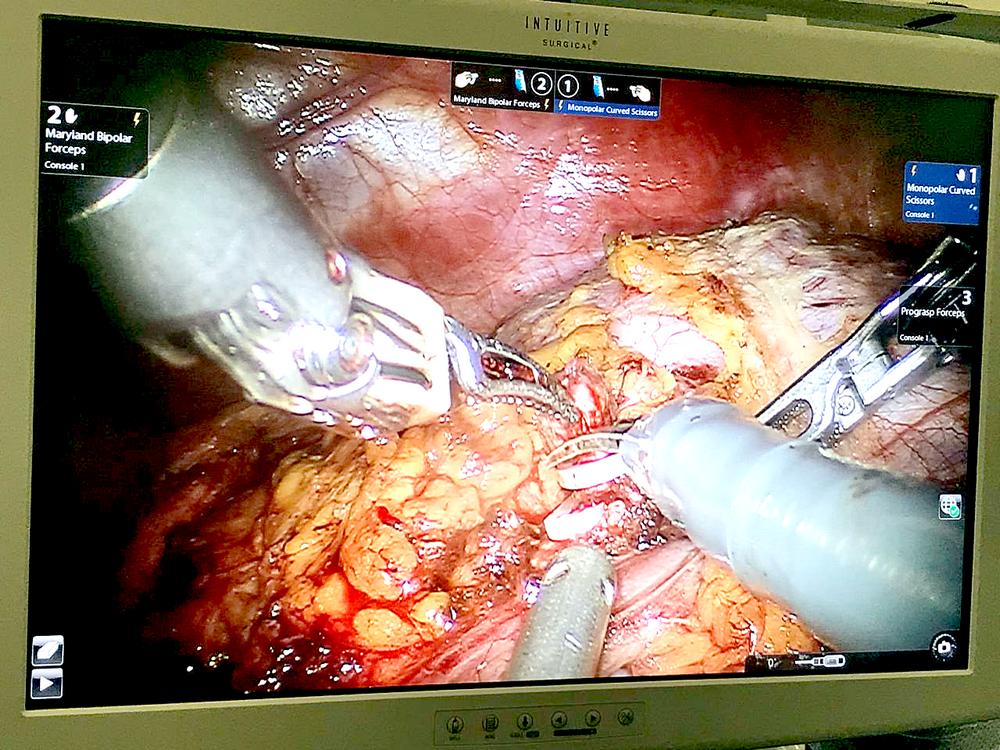 f7b019e7-8691-4adf-8938-d835d1752007_0