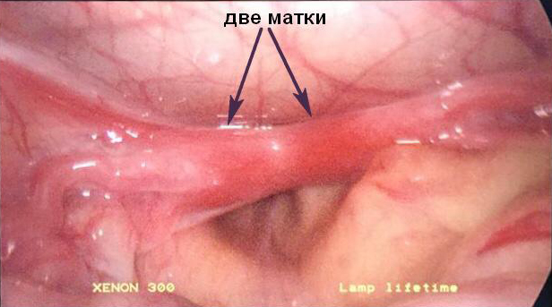 Две матки_0_0