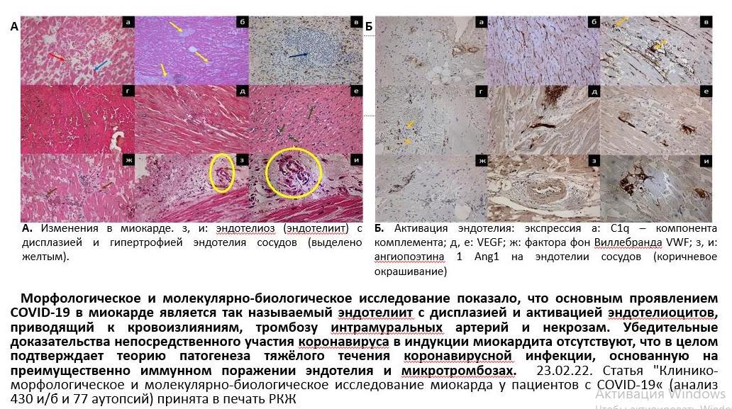 Исследование COVID-19_0