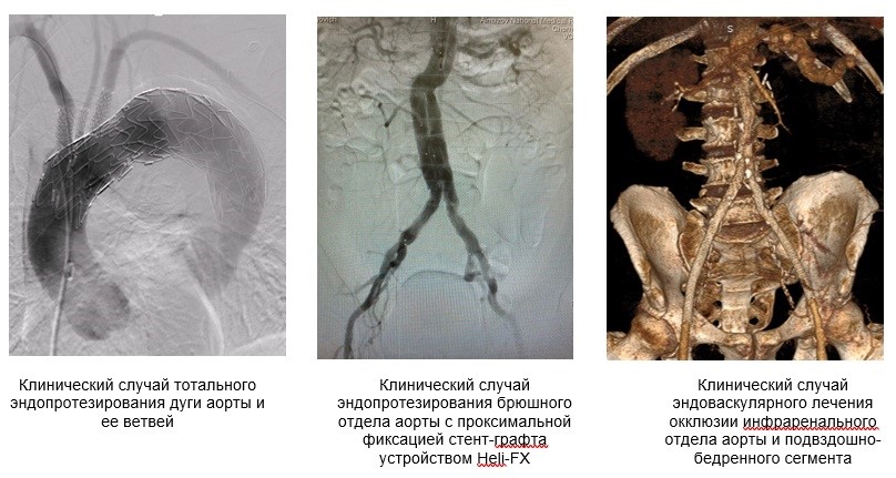 НИЛ клиническая работа