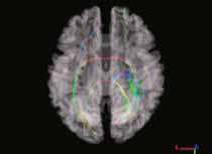 НИО лучевая диагностика 2png