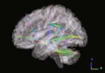 НИО лучевая диагностика 3png