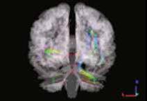 НИО лучевая диагностика 4png