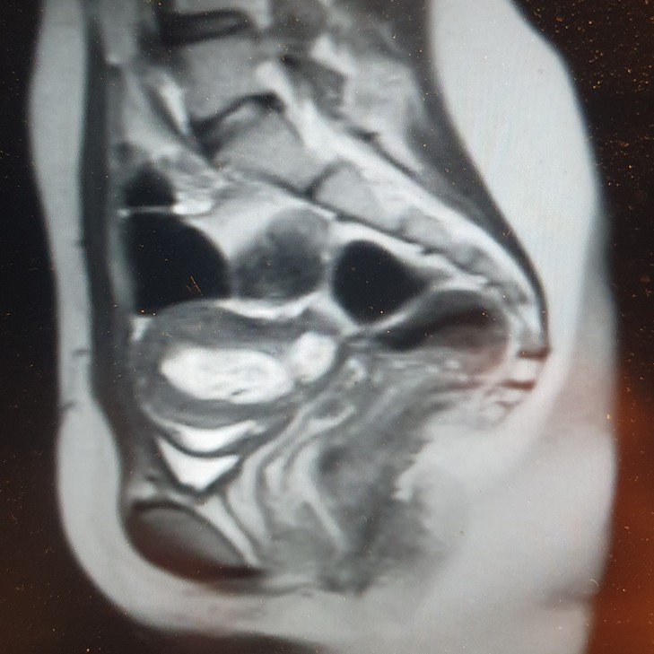 Падение с велосипеда_фото2-корр