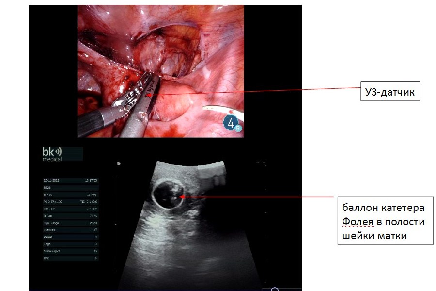 для новости