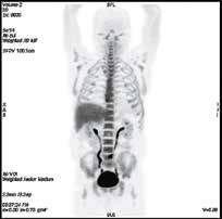 онкология и гематология2