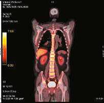 онкология и гематология3