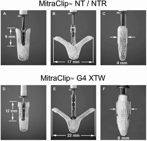 операция МитраКлип-4
