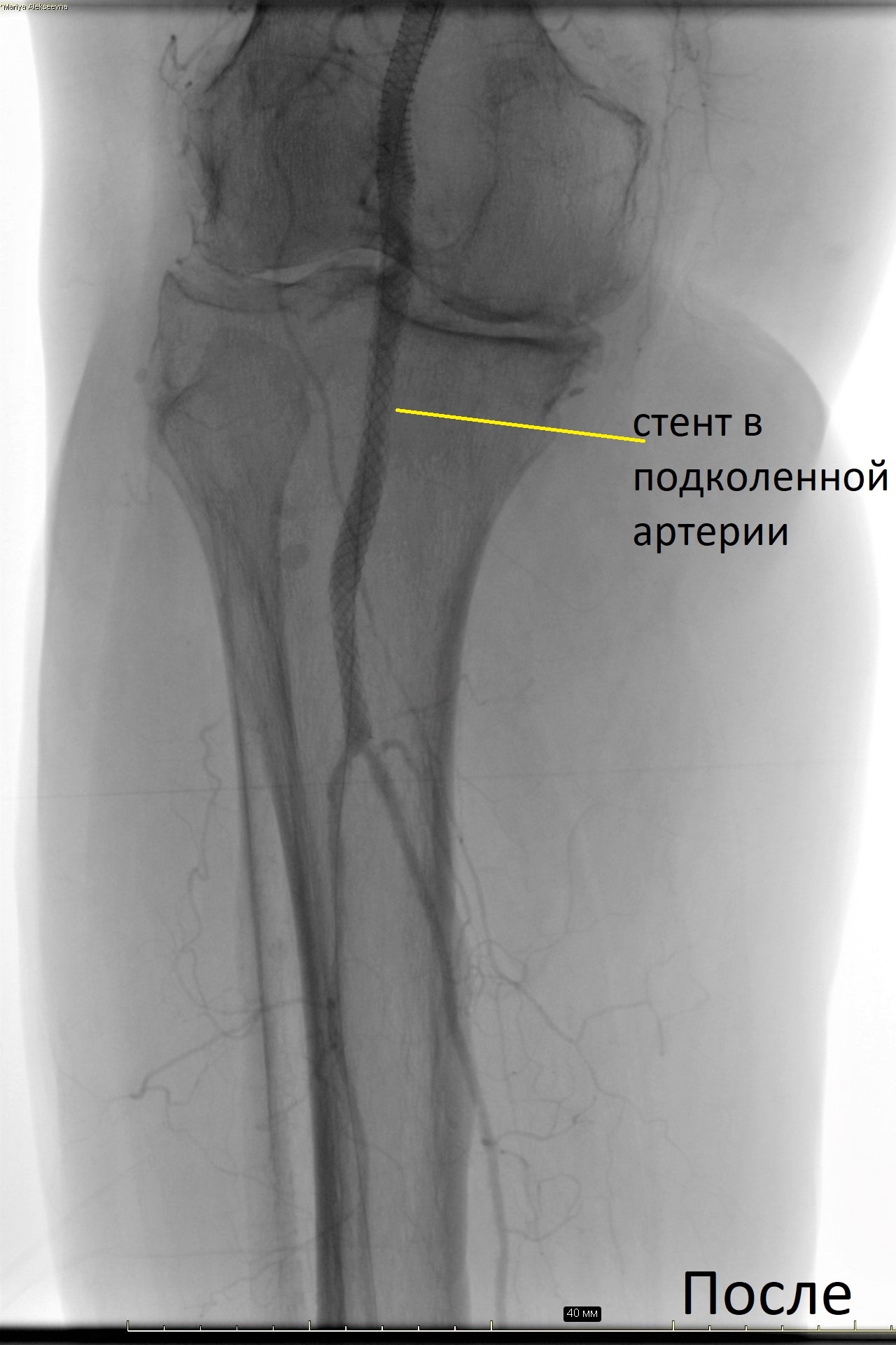 операция после