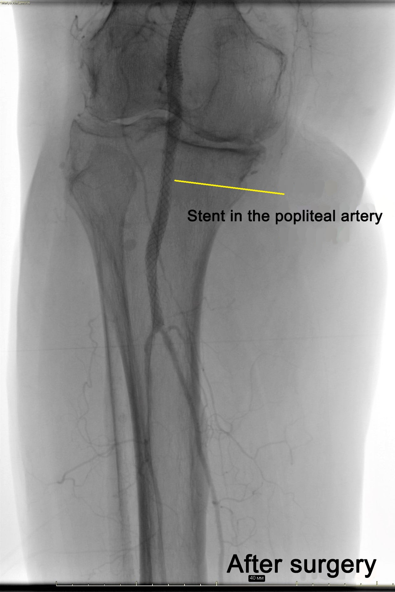 операция после